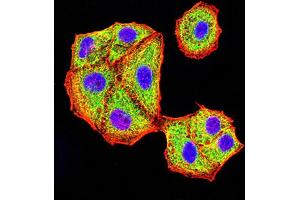 Immunocytochemistry (ICC) image for anti-V-Akt Murine Thymoma Viral Oncogene Homolog 3 (Protein Kinase B, Gamma) (AKT3) (AA 37-150) antibody (ABIN5912022) (AKT3 Antikörper  (AA 37-150))