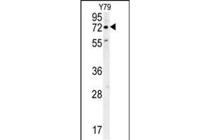Western blot analysis in Y79 cell line lysates (35ug/lane). (RFT1 Antikörper  (C-Term))