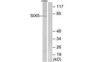 Western Blotting (WB) image for anti-Homeobox protein SIX5 (SIX5) (Internal Region) antibody (ABIN1851463) (Six5 Antikörper  (Internal Region))