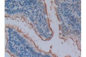 Immunohistochemistry (IHC) image for anti-Glutamyl Aminopeptidase (Aminopeptidase A) (ENPEP) (AA 409-624) antibody (ABIN7442879)