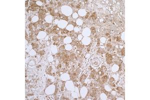 Immunohistochemistry (IHC) image for anti-Heat Shock 27kDa Protein 1 (HSPB1) (AA 155-205) antibody (ABIN7453920) (HSP27 Antikörper  (AA 155-205))