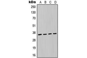 Western blot analysis of MAGEA6 expression in A549 (A), MCF7 (B), NIH3T3 (C), H9C2 (D) whole cell lysates.