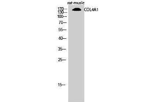 Western Blotting (WB) image for anti-Collagen, Type IV, alpha 1 (COL4A1) (N-Term) antibody (ABIN3184012) (COL4A1 Antikörper  (N-Term))