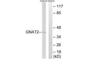 Western blot analysis of extracts from COLO cells, using GNAT2 antibody. (GNAT2 Antikörper)