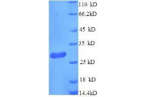 SDS-PAGE (SDS) image for neonatal Fc Receptor (FcRn) (AA 24-297), (Extracellular) protein (His tag) (ABIN5713450)