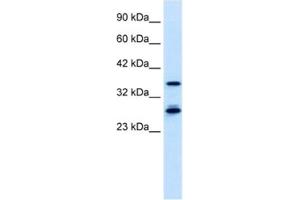 Western Blotting (WB) image for anti-Metal Response Element Binding Transcription Factor 2 (MTF2) antibody (ABIN2460909) (MTF2 Antikörper)