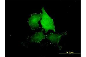 Immunofluorescence of purified MaxPab antibody to TNS4 on HeLa cell. (Tensin 4 Antikörper  (AA 1-480))