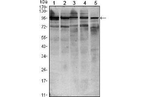 Western blot analysis using STAT6 mouse mAb against HEK293 (1), NIH/3T3 (2), MCF-7 (3), Raw246.