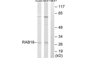 Western blot analysis of extracts from HuvEc cells and MCF-7 cells, using RAB18 antibody. (RAB18 Antikörper  (Internal Region))