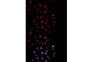 Immunofluorescence analysis of MCF-7 cells using Phospho-FOS-T232 antibody (ABIN5969895). (c-FOS Antikörper  (pThr232))