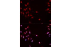 Immunofluorescence analysis of MCF-7 cells using Phospho-CHEK1-S317 antibody (ABIN5969879). (CHEK1 Antikörper  (pSer317))