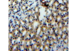 Used in DAB staining on fromalin fixed paraffin-embedded kidney tissue (S100A3 Antikörper  (AA 1-101))