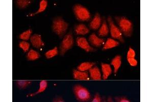 Immunofluorescence analysis of HeLa cells using CDK7 Polyclonal Antibody at dilution of 1:100 (40x lens). (CDK7 Antikörper)