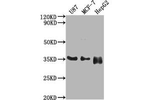 Western Blot Positive WB detected in: U87 whole cell lysate, MCF-7 whole cell lysate, HepG2 whole cell lysate All lanes: HMGCL antibody at 1:2000 Secondary Goat polyclonal to rabbit IgG at 1/50000 dilution Predicted band size: 35, 27, 21 kDa Observed band size: 35 kDa (HMGCL Antikörper  (AA 28-325))