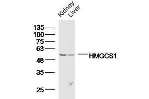 Lane 1: Mouse kidney lysates, Lane 2: Mouse liver lysates probed with HMGCS1 Polyclonal Antibody, Unconjugated  at 1:300 overnight at 4˚C. (HMGCS1 Antikörper  (AA 41-150))