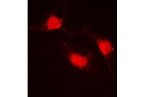 Immunofluorescent analysis of Beta-catenin staining in HeLa cells. (beta Catenin Antikörper  (C-Term))