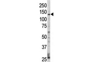 Western blot analysis of ErbB4 / HER4 antibody and HL-60 cell lysate. (ERBB4 Antikörper  (AA 25-55))