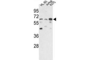 Western blot of hPPP3CC-E33 AP31353PU-N in HL-60, Jurkat, A375 cell line lysates (35 ug/lane). (PPP3CC Antikörper  (N-Term))