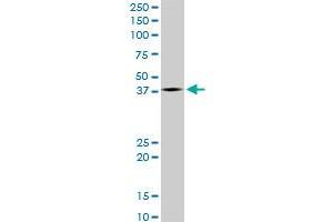 LHX4 monoclonal antibody (M05), clone 4D7. (LHX4 Antikörper  (AA 208-306))