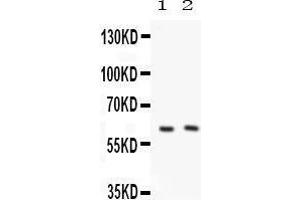 Anti-PKLR Picoband antibody, Western blotting All lanes: Anti PKLR  at 0. (PKLR Antikörper  (C-Term))