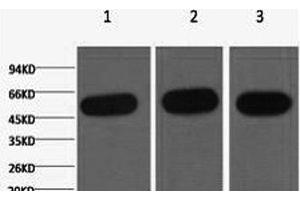 Western Blot analysis of 1) Hela, 2) Mouse kidney, 3) Rat heart using beta Tubulin Monoclonal Antibody at dilution of 1:5000. (TUBB Antikörper)