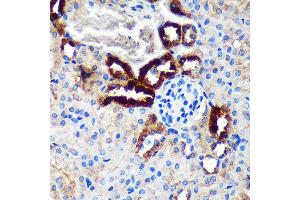 Immunohistochemistry of paraffin-embedded Mouse kidney using EML4 Rabbit pAb (ABIN7266891) at dilution of 1:100 (40x lens). (EML4 Antikörper  (AA 360-560))