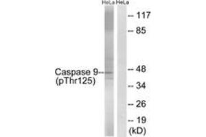 Western blot analysis of extracts from HeLa cells treated with TNF 20ng/ml 5'+calyculinA 50ng/ml 5', using Caspase 9 (Phospho-Thr125) Antibody. (Caspase 9 Antikörper  (pThr125))