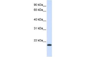 NKAIN1 antibody used at 1 ug/ml to detect target protein. (NKAIN1 Antikörper  (Middle Region))
