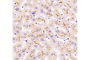 Immunohistochemistry of paraffin embedded human liver using Kiaa1324 (ABIN7073822) at dilution of 1:2500 (400x lens) (ELAPOR1 Antikörper)
