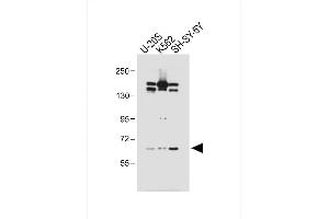 All lanes : Anti-LM3 Antibody (C-term) at 1:1000 dilution Lane 1: U-20S whole cell lysate Lane 2: K562 whole cell lysate Lane 3: SH-SY-5Y whole cell lysate Lysates/proteins at 20 μg per lane. (PALM3 Antikörper  (C-Term))