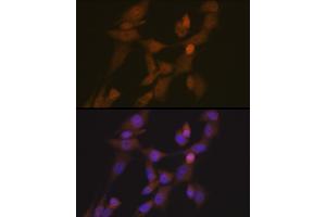 Immunofluorescence analysis of NIH-3T3 cells using STK33 Rabbit mAb (ABIN7270224) at dilution of 1:100 (40x lens). (STK33 Antikörper)
