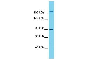 Western Blotting (WB) image for anti-Storkhead Box 2 (STOX2) (C-Term) antibody (ABIN2791141) (STOX2 Antikörper  (C-Term))