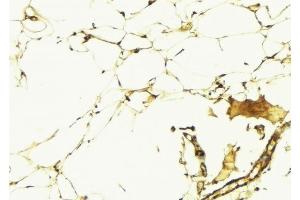 Immunohistochemistry (IHC) image for anti-Angiotensin II Receptor, Type 1 (AGTR1) (N-Term) antibody (ABIN6256893)