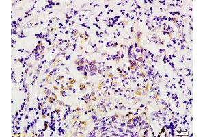 Immunohistochemistry (Paraffin-embedded Sections) (IHC (p)) image for anti-Leucine-Rich Repeat Containing G Protein-Coupled Receptor 5 (LGR5) (AA 810-907) antibody (ABIN737916)