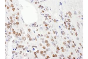 Immunohistochemistry (IHC) image for anti-KH-Type Splicing Regulatory Protein (KHSRP) (AA 100-150) antibody (ABIN7454801)
