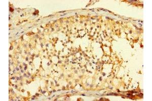 Immunohistochemistry of paraffin-embedded human testis tissue using ABIN7165534 at dilution of 1:100 (FAM71A Antikörper  (AA 381-594))