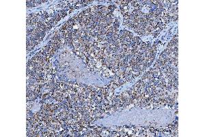 IHC analysis of TRK fused gene/TFG using anti-TRK fused gene/TFG antibody (ABIN7599839). (TFG Antikörper  (AA 121-400))