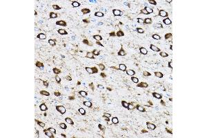 Immunohistochemistry of paraffin-embedded rat brain using RPL17 Rabbit pAb (ABIN6128342, ABIN6147115, ABIN6147116 and ABIN6221632) at dilution of 1:100 (40x lens).