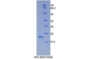 SDS-PAGE (SDS) image for Periostin (POSTN) (AA 500-630) protein (His tag) (ABIN1080493)