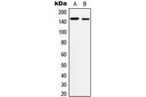 Western blot analysis of c-Met (pY1234) expression in A431 (A), HepG2 (B) whole cell lysates. (c-MET Antikörper  (C-Term, pTyr1234))