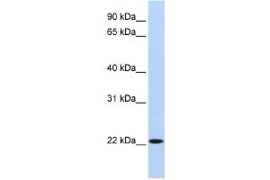 Western Blotting (WB) image for anti-Synovial Sarcoma, X Breakpoint 5 (SSX5) antibody (ABIN2458407) (SSX5 Antikörper)