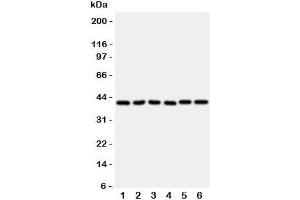 Western blot testing of WISP1 antibody and rat samples 1: heart;  2: kidney;  3: lung;  and human samples 4: A549;  5: A431;  6: COLO320 cell lysate (WISP1 Antikörper  (C-Term))