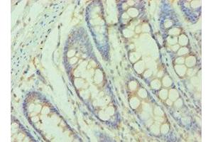 Immunohistochemistry of paraffin-embedded human colon tissue using ABIN7155523 at dilution of 1:100 (SMYD3 Antikörper  (AA 199-428))