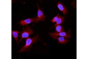 IF analysis of Cytochrome P450 2B6/CYP2B6 using anti-Cytochrome P450 2B6/CYP2B6antibody (ABIN6719476).