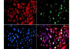 Immunofluorescence analysis of GFP-RNF168 transgenic U2OS cells using UIMC1 antibody (ABIN5974363). (UIMC1 Antikörper)