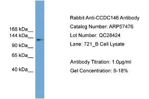 WB Suggested Anti-CCDC146  Antibody Titration: 0. (CCDC146 Antikörper  (Middle Region))