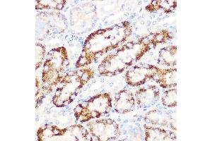 Immunohistochemistry of paraffin-embedded mouse kidney using  Rabbit mAb (ABIN7265591) at dilution of 1:100 (40x lens). (ANGPTL3 Antikörper)