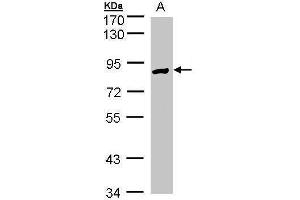 WB Image Sample(30 ug whole cell lysate) A:Hep G2 , 7. (Glucose-6-Phosphate Dehydrogenase Antikörper)