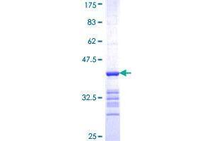 Image no. 1 for Semaphorin 4G (SEMA4G) (AA 24-115) protein (GST tag) (ABIN1319486) (SEMA4G Protein (AA 24-115) (GST tag))