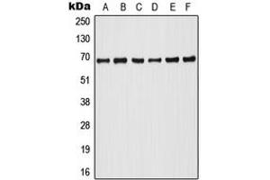 Western blot analysis of A-RAF (pY302) expression in HeLa PMA-treated (A), Raji (B), HT29 (C), NIH3T3 (D), SP2/0 PMA-treated (E), PC12 PMA-treated (F) whole cell lysates. (ARAF Antikörper  (pTyr302))